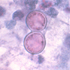 Blastomyces