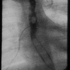 Clostridium botulinum type B