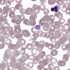 Plasmodium vivax