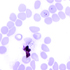 Plasmodium vivax