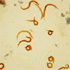 Strongyloides stercoralis