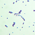 Listeria monocytogenes