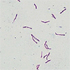 Mycobacterium tuberculosis