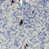 Cytomegalovirus