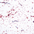 Listeria monocytogenes