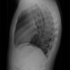 Mycobacterium tuberculosis