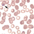 Babesia microti