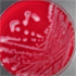 Klebsiella pneumoniae