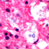 Cryptococcus neoformans