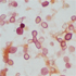 Cryptococcus neoformans