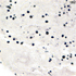 Cryptococcus neoformans