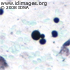 Cryptococcus neoformans