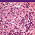 Mycobacterium tuberculosis