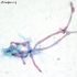 Rhizopus