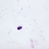 Plasmodium falciparum