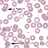 Plasmodium falciparum