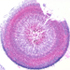 Aspergillus fumigatus