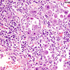 Cytomegalovirus