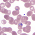 Babesia microti