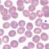 Babesia microti