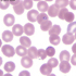 Babesia microti