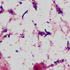 Rhodococcus equi