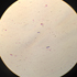 Bacillus cereus