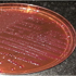 Burkholderia pseudomallei