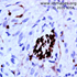 Mycobacterium leprae