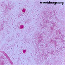 Streptococcus pneumoniae