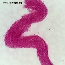 Mycobacterium marinum