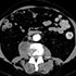 Mycobacterium bovis