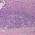 Treponema pallidum