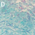 Chrysosporium