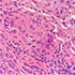 Chrysosporium