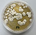Chrysosporium