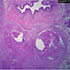 Mycobacterium bovis