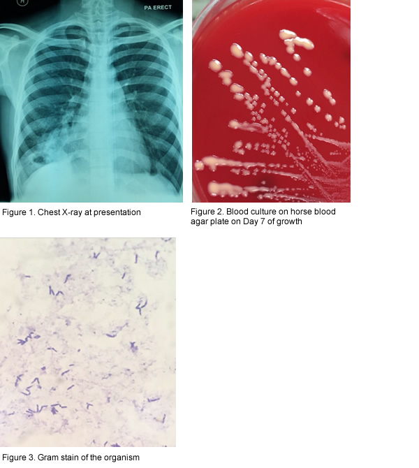 <p>A man in his twenties presented to a Malaysian hospital with fever, cough and hemoptysis for 3 months and was diagnosed with new HIV infection. He had a CD4+ T-cell count of 18 cells/uL. Shown are his chest X-ray at presentation (Fig.1); his blood culture on horse blood agar plate on Day 7 of growth (Fig.2) and Gram stain of the organism (Fig.3). Which of the following organisms is the cause of his respiratory illness?</p>
