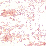 Legionella