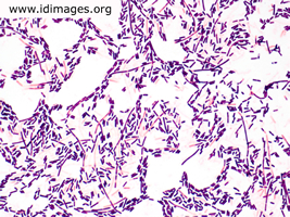 Clostridium Images - Partners Infectious Disease Images ...