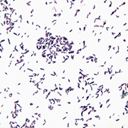 Corynebacterium