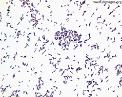 Corynebacterium Images - Infectious Disease Images - eMicrobes Digital ...