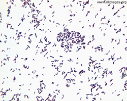 corynebacterium xerosis morphology