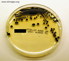 Figure 3.  <i>Corynebacterium diphtheriae</i> growth on Tellurite plate.