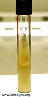 Figure 4.  <i>Corynebacterium diphtheriae</i> growth on Loeffler slant.