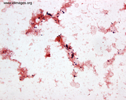 Listeria Images - Infectious Disease Images - eMicrobes ...