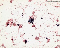 staphylococcus epidermidis gram stain