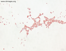 Figure 1.  Gram stain of culture growth of <i>Brucella</I>  <i>melitensis</i> biovar 3.