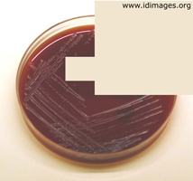 Figure 2.  <i>Brucella</i> colonies on horse blood  agar plate.
