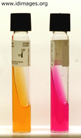 Figure 3. Urease slants, <i>Brucella</i> inoculate on right.